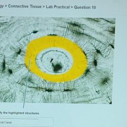 Nervous tissue histology pal question practical highlighted identify solved answers